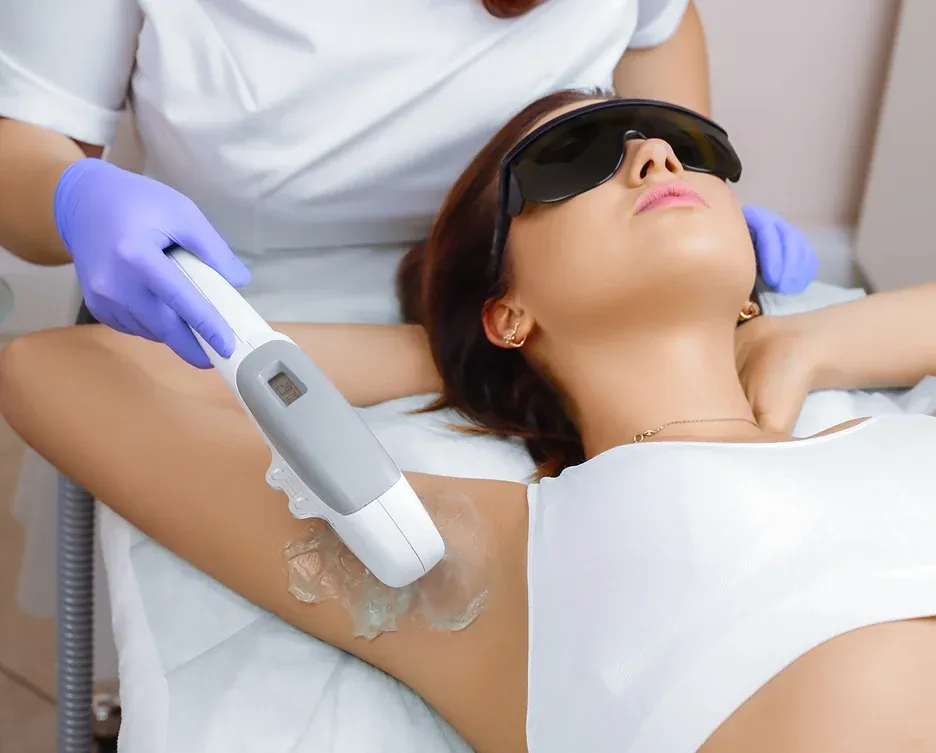laser hair removal treatment