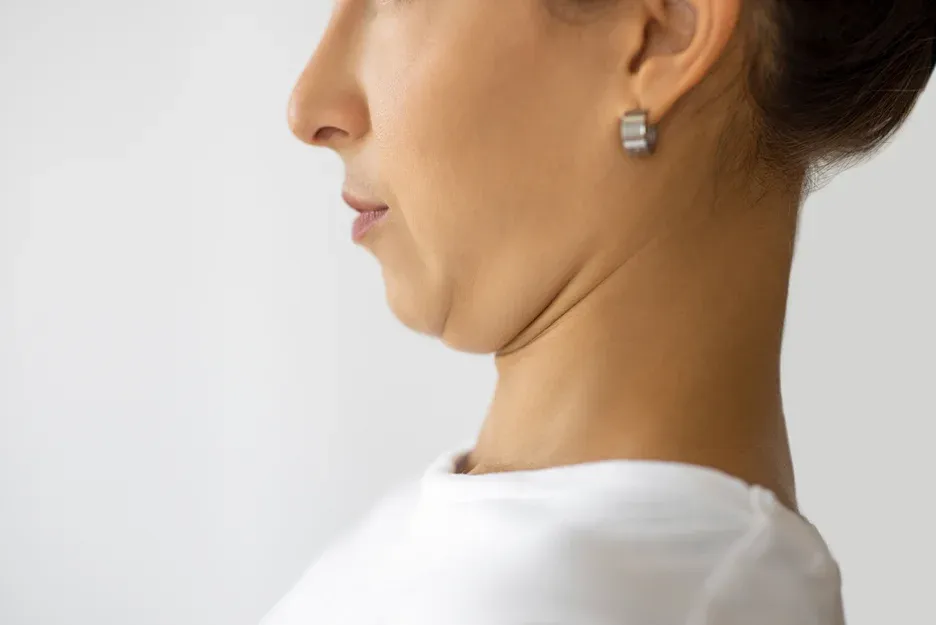 double chin in a skinny woman