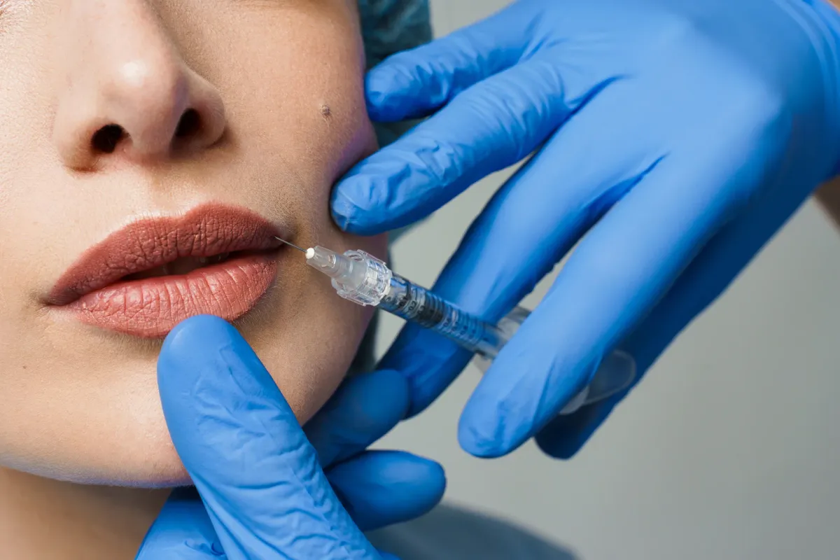 Can Dissolving Lip Fillers Cause Swelling?