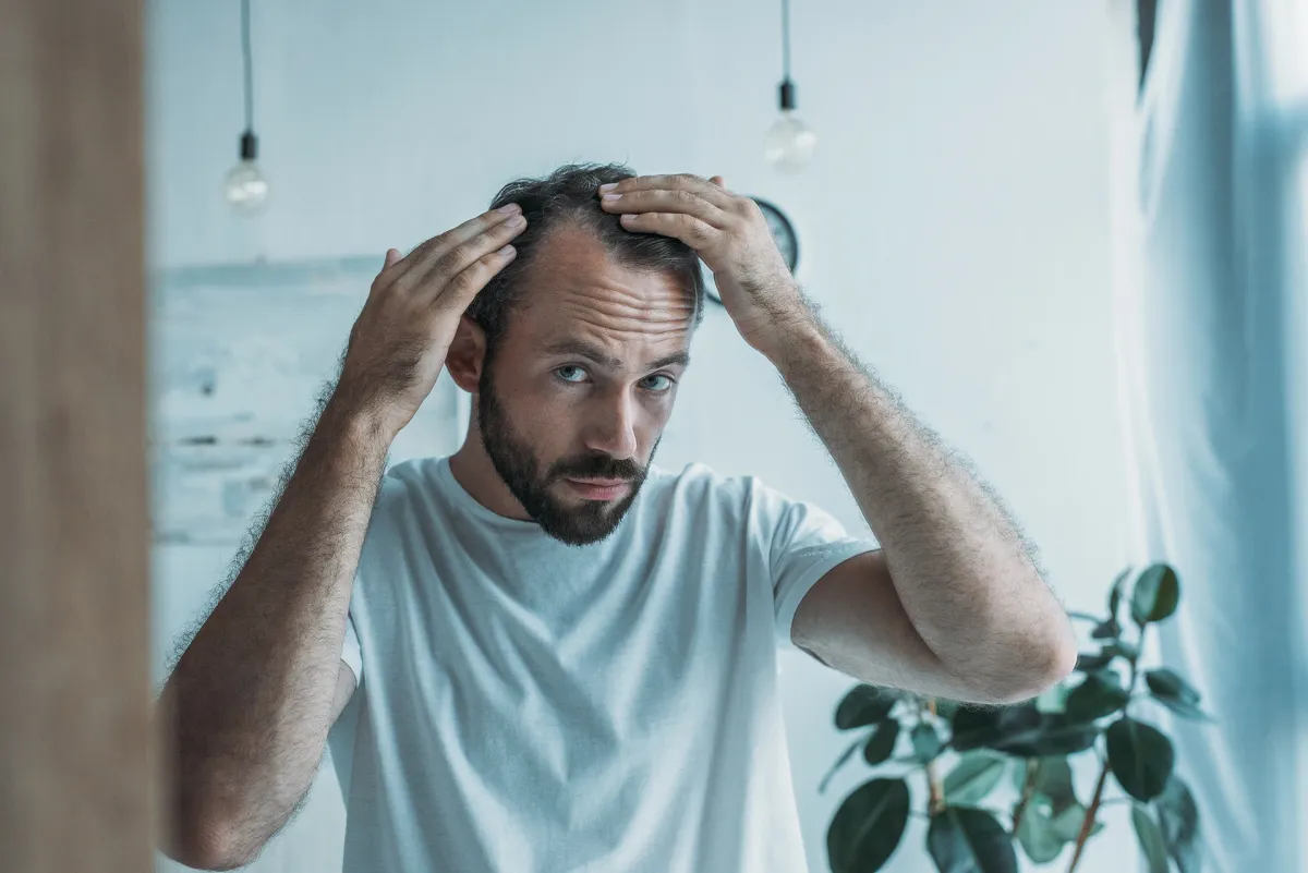 The Truth About TRT and Hair Loss: What You Need to Know