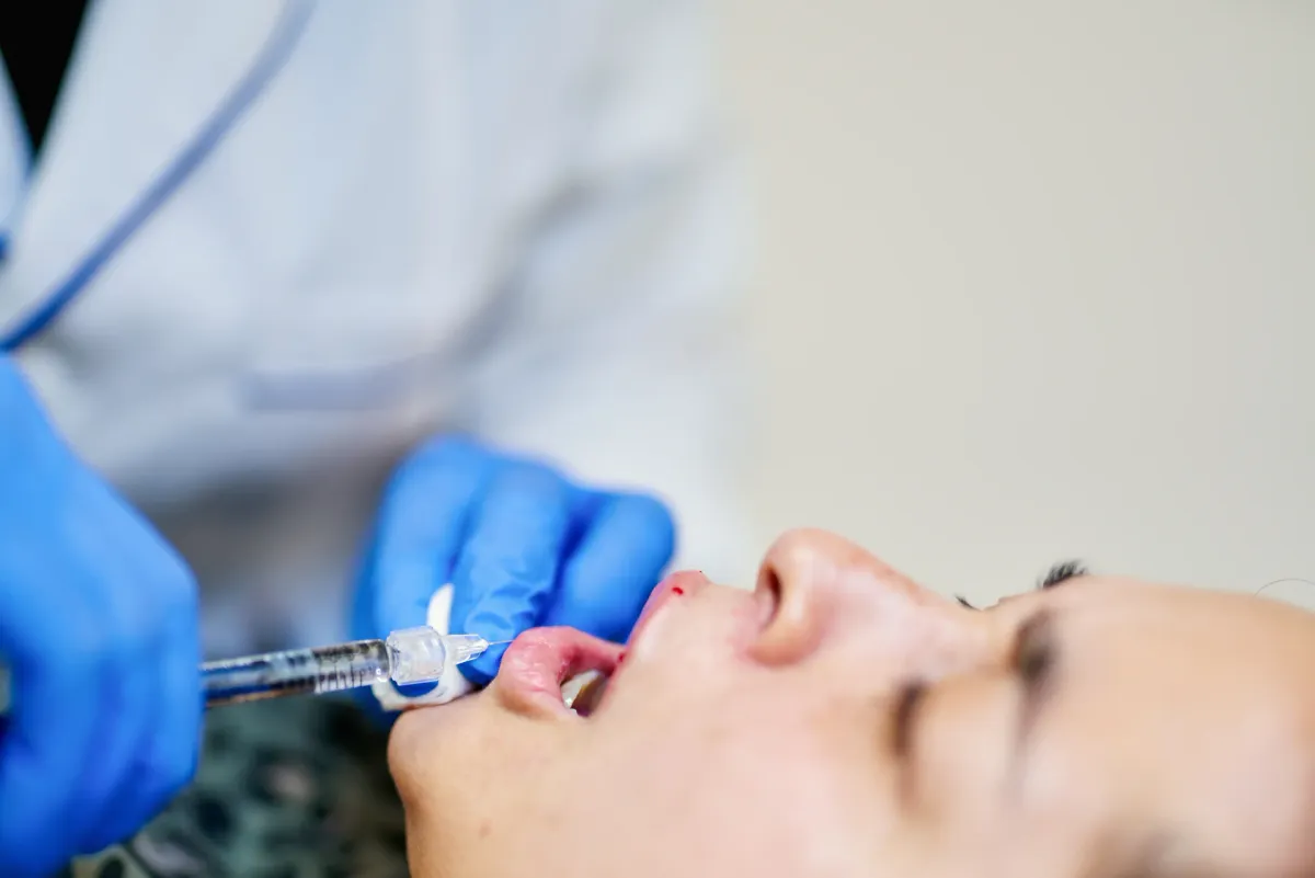 How to Sleep After Lip Filler Treatments for Optimal Healing