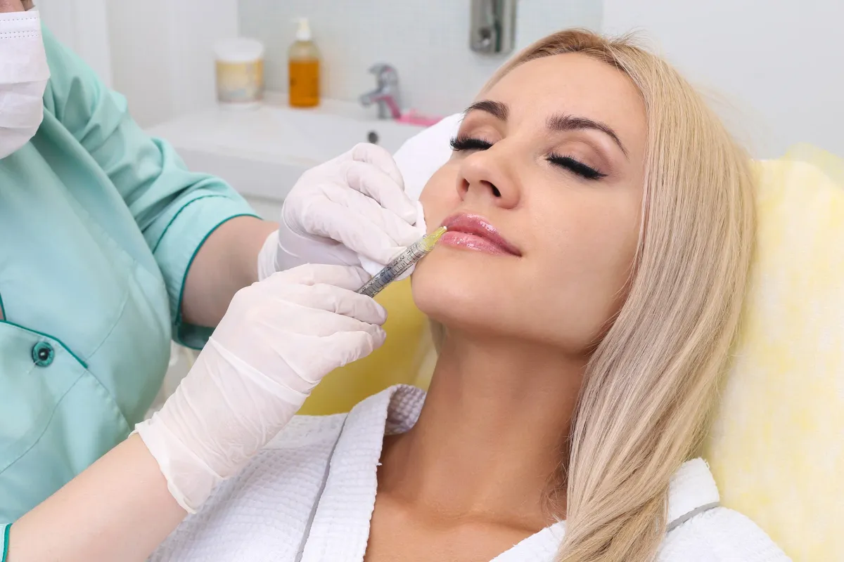 Is Purple Bruising After Lip Fillers Normal?