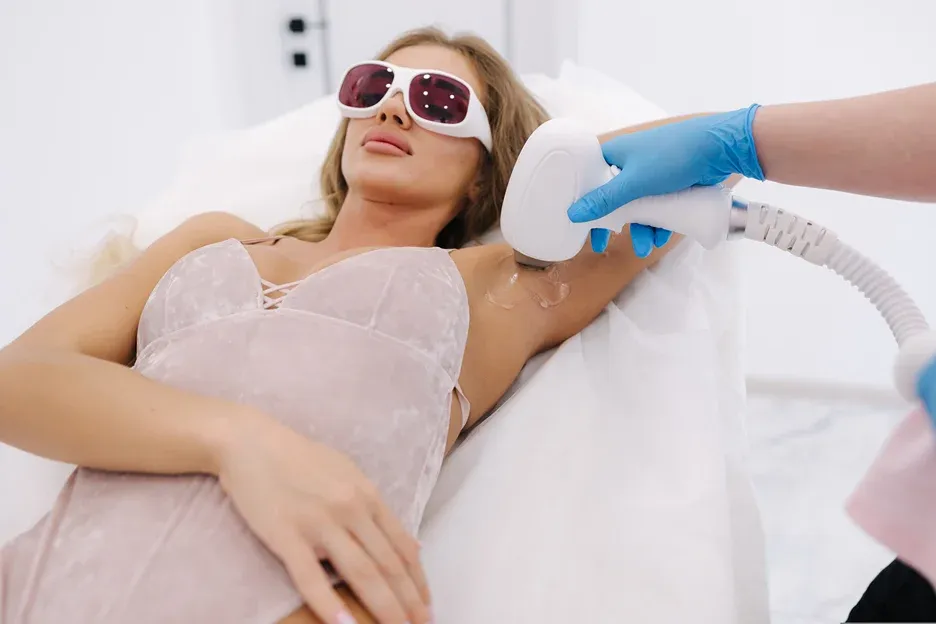 laser hair removal treatment