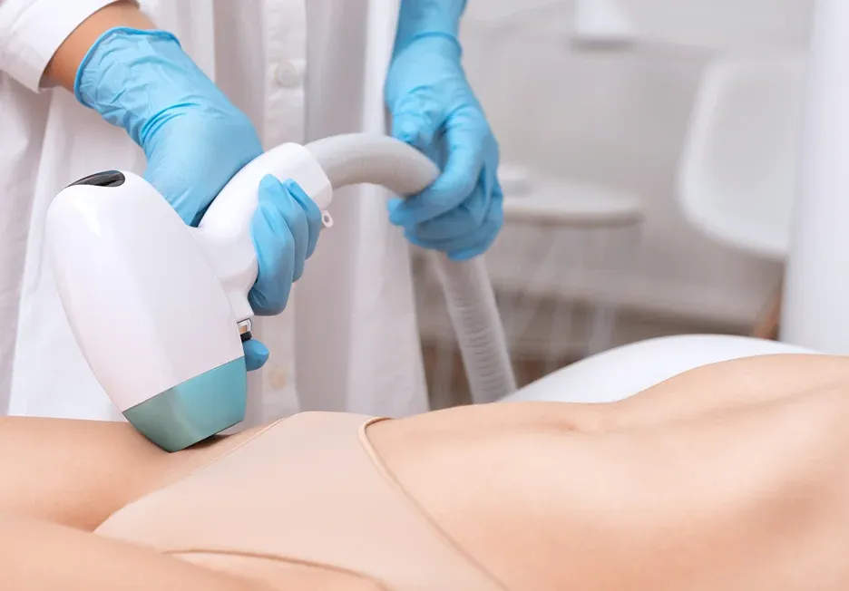 laser hair removal treatment