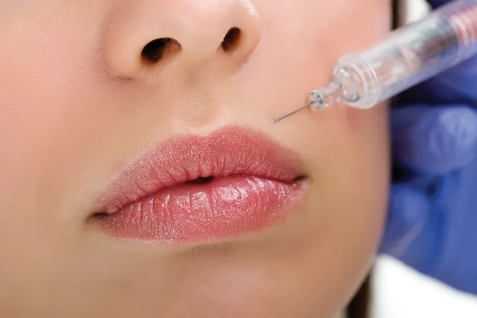 lip filler treatment