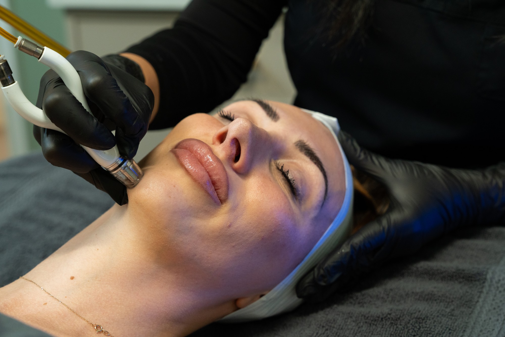 Professional skin resurfacing session
