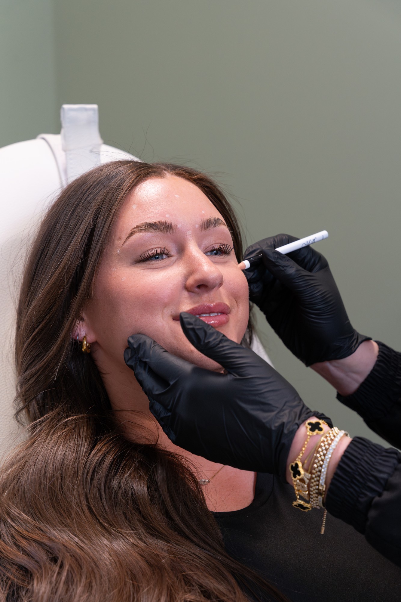 Dysport injection session