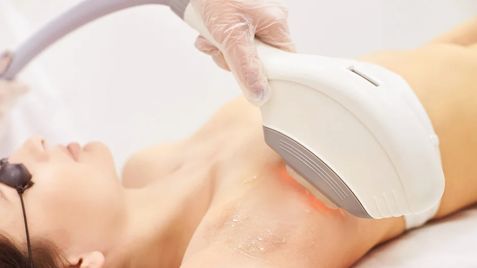 armpit laser hair removal treatment
