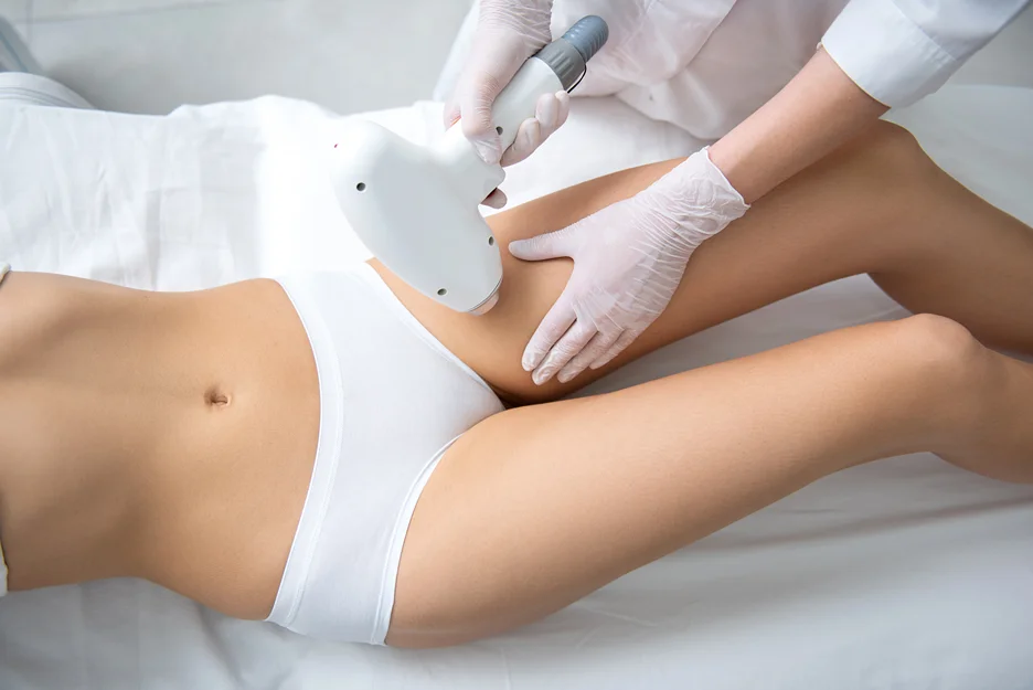 laser hair removal treatment on bikini area