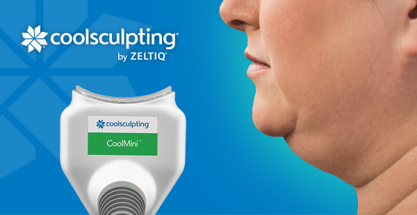 double chin coolsculpting procedure
