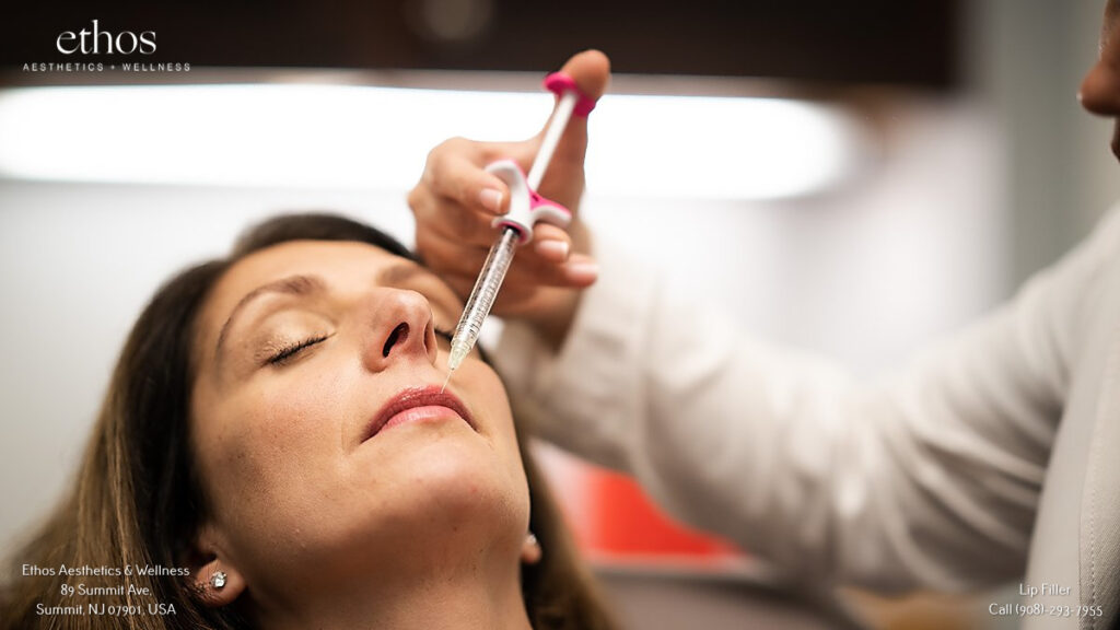 a woman received lip filler injection 