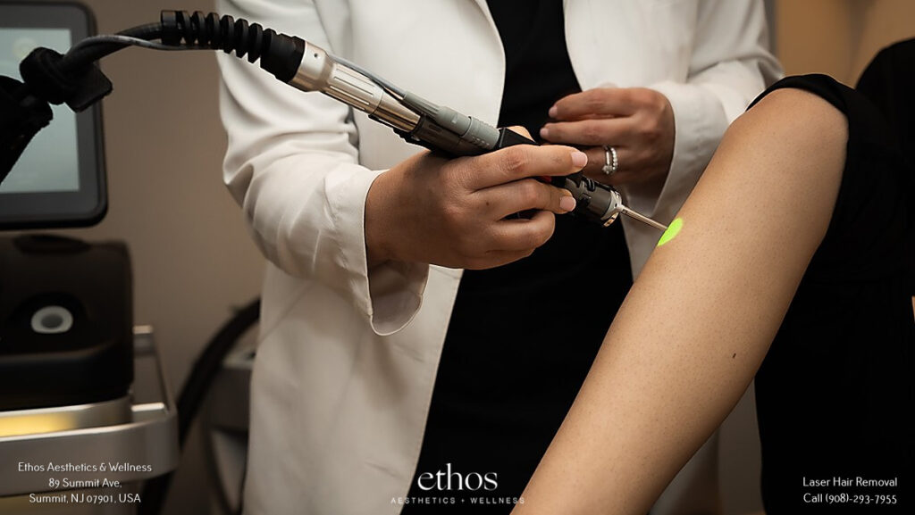 laser hair removal treatment at Ethos Aesthetics & Wellness clinic