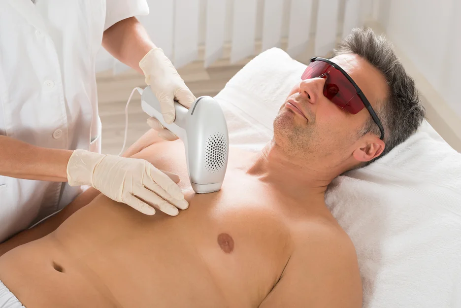 laser hair removal treatment on chest