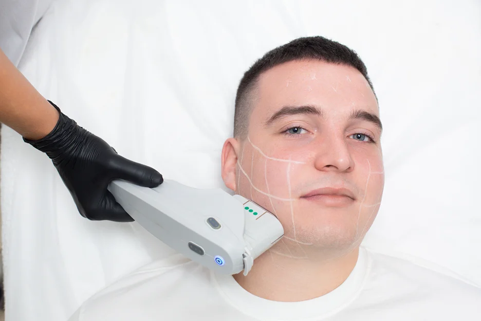 a man getting laser hair removal treatment
