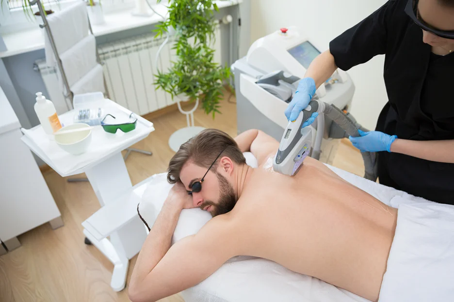Laser Hair Removal On Man's Back