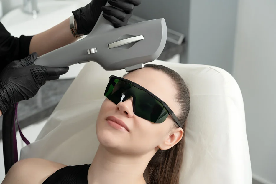 laser hair removal treatment for hairline