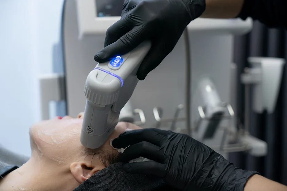laser hair removal treatment on head