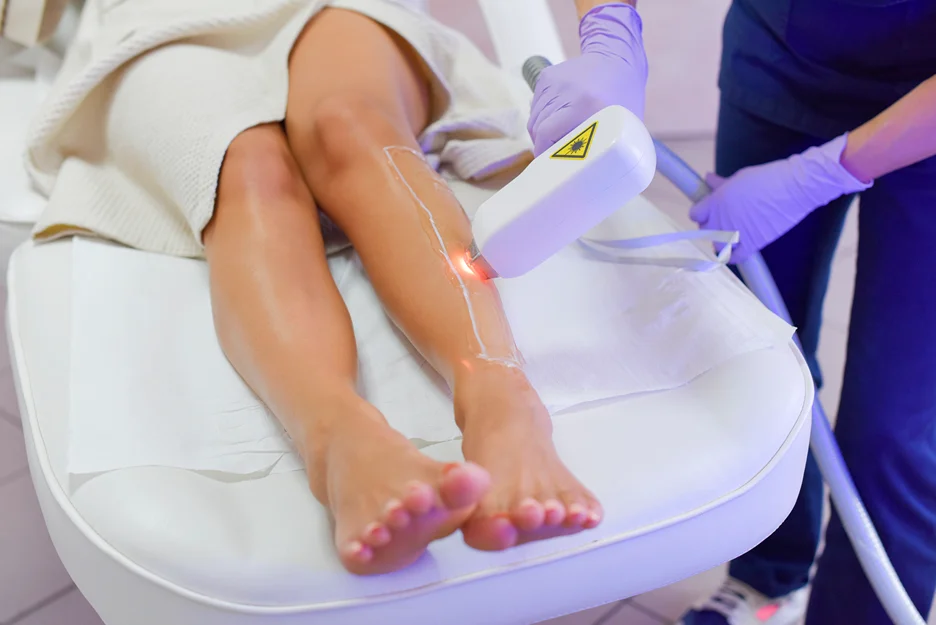 laser hair removal treatment on legs