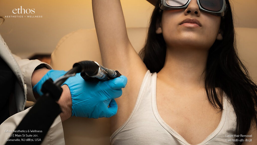 laser hair removal treatment on armpit
